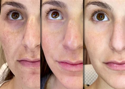 Transforming Dull Skin with the Partially Magical Radiance Pill